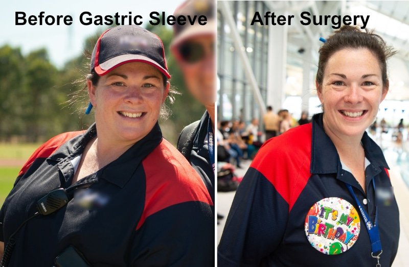 Sarah before and after