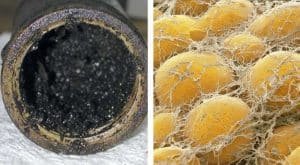 drain pipe and fat cells