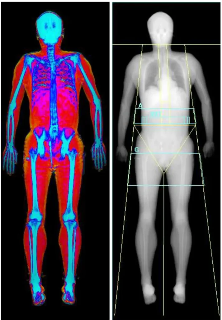 Muscle and Fat Composition