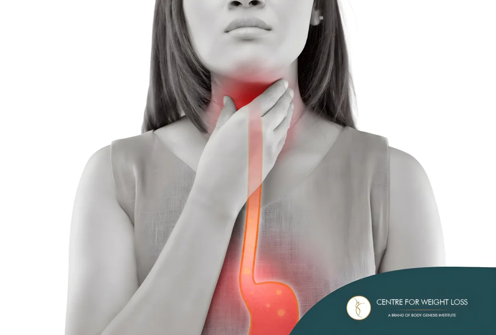 Silent or atypical reflux